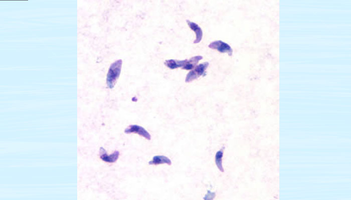 toxo 