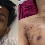 Jantar Mantar protest pellet guns injury